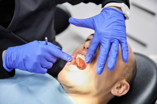 Best Emergency Denture Repair in Berwyn, PA